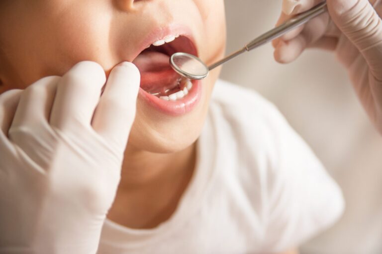 a close up image of a baby's teeth being checked by a dentist